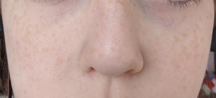 Based on these photos, do I need to wear foundation everyday? Does my skin look that bad?
