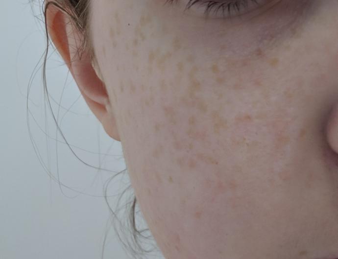 Based on these photos, do I need to wear foundation everyday? Does my skin look that bad?