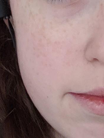 Based on these photos, do I need to wear foundation everyday? Does my skin look that bad?