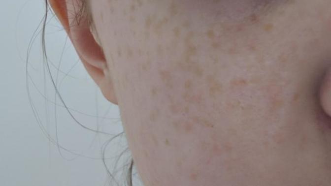 Based on these photos, do I need to wear foundation everyday? Does my skin look that bad?