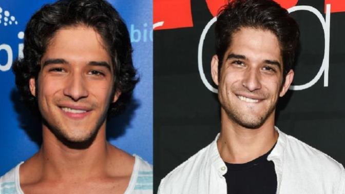 Are people with asymmetrical facial features still attractive to you?