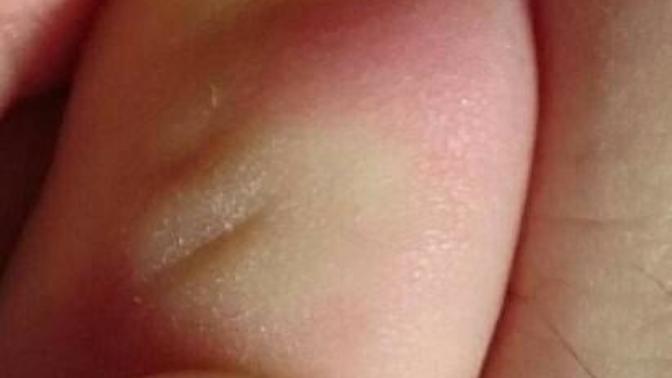 Any tips for toe nails?