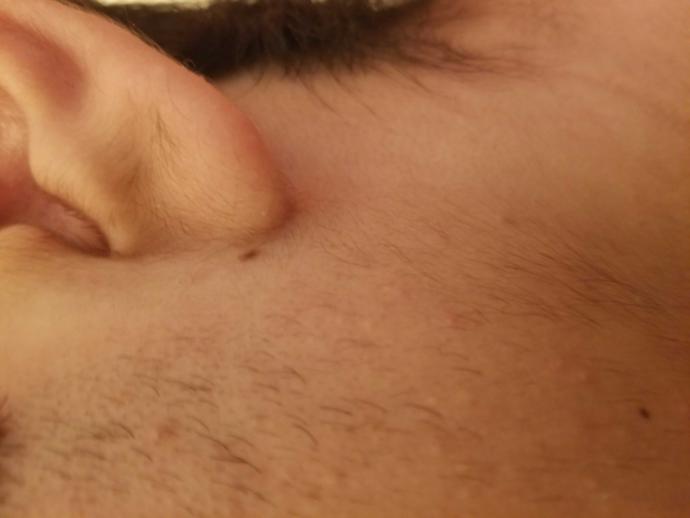 Im 17, is it normal to have earlobe hair at that age?