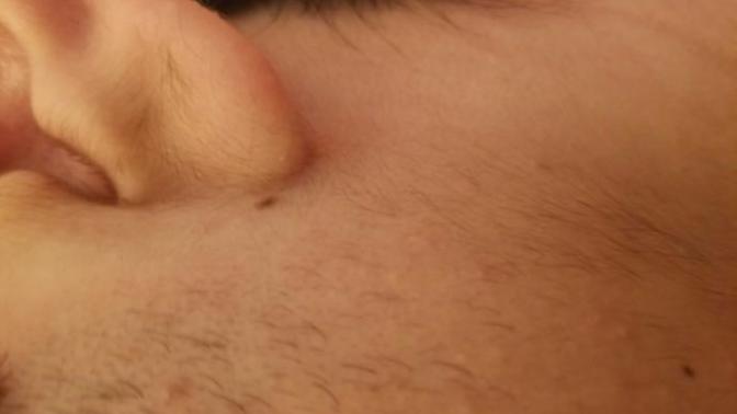 Im 17, is it normal to have earlobe hair at that age?