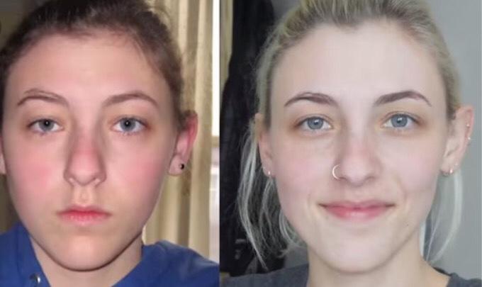 Are People More Amazed At The Transformation Of A Girl To A Woman Than The Transformation Of A Boy To A Man?