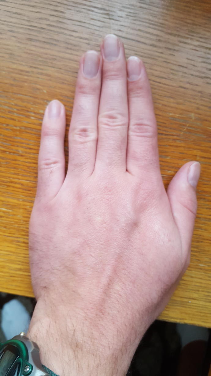 Do You Have Nice Hands/Feet?