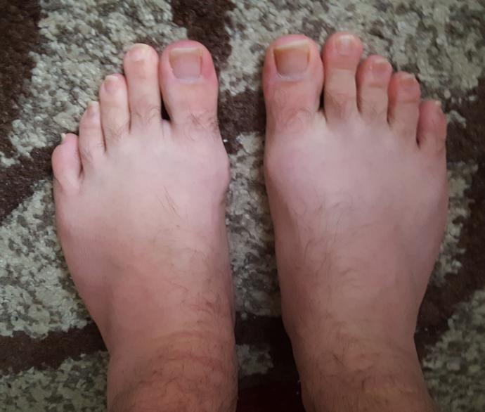 Do You Have Nice Hands/Feet?