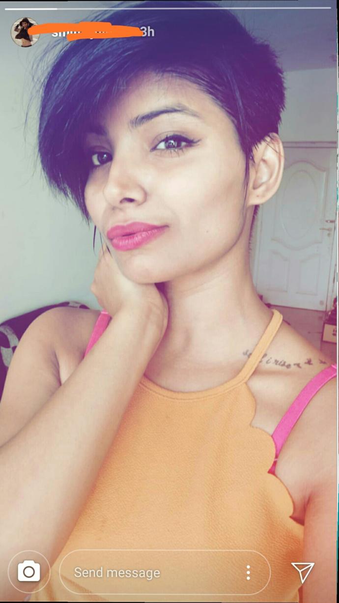 Do you think the girl in the pic (in description) did lips surgery?