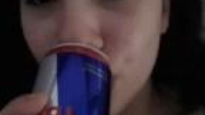 How bad are my dark undereyes?