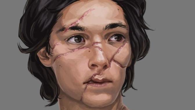 Could You Date Someone Who Has Been Disfigured?