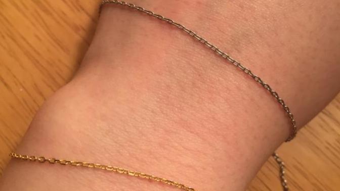 Which looks better with my skin: gold or silver jewelry?