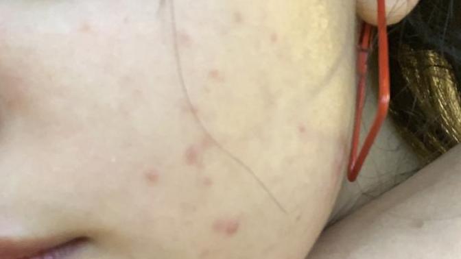 Someone please help me with my skin😭?