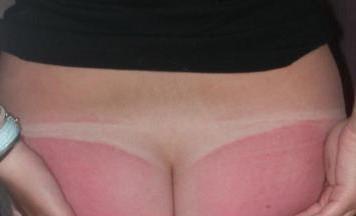 Butt torture?!? Would you rather?