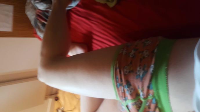 Are my legs fat?