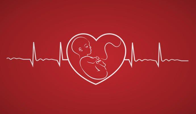 What is your opinion on the heartbeat bills which ban abortions past 6 weeks?