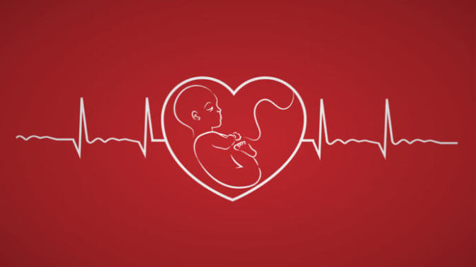 What is your opinion on the heartbeat bills which ban abortions past 6 weeks?