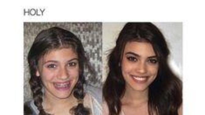 How may I glow up to a better-looking teen?