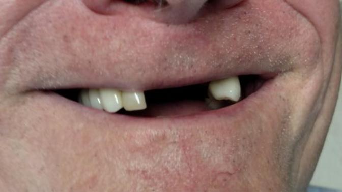 So the people of Boston are missing two front teeth?