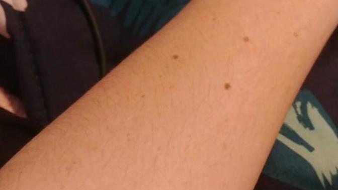 Is arm hair a turnoff?