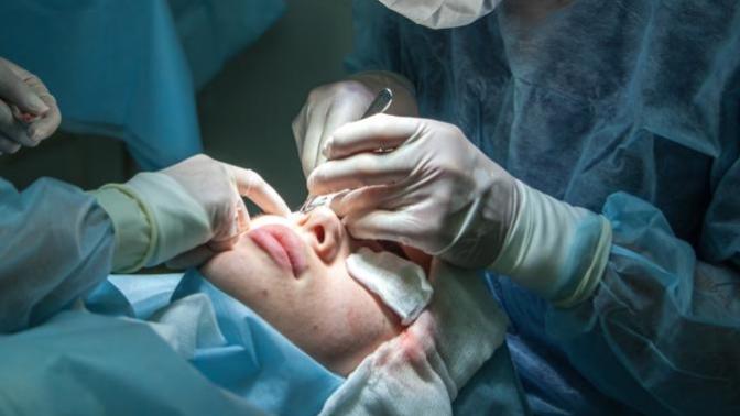Do you have less respect for people who get plastic surgery?