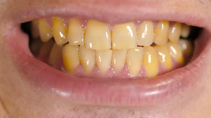 How many times a day do you brush your teeth?