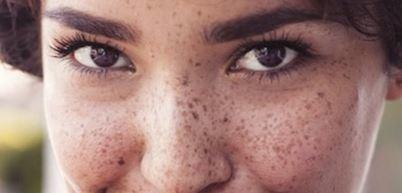 What do you think about freckles on a girl?