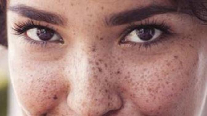 What do you think about freckles on a girl?