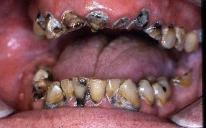 Are big/wide teeth unattractive?