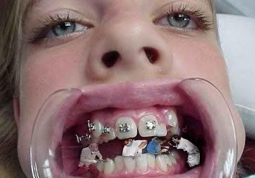 Are big/wide teeth unattractive?