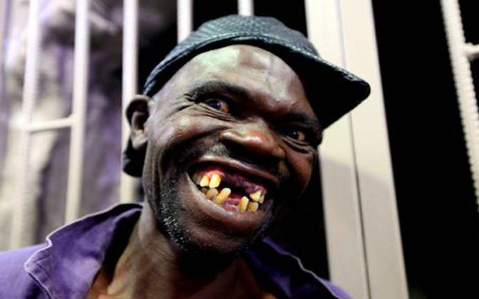 Are big/wide teeth unattractive?