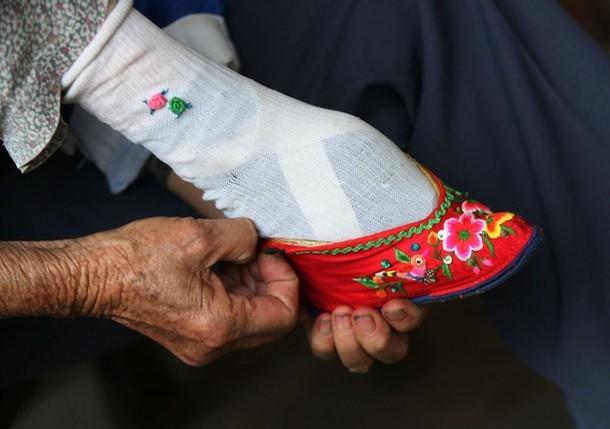 What's Worst Between Foot Binding & Circumcision?