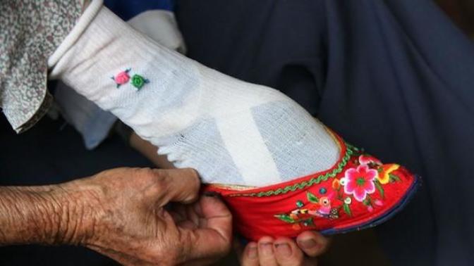 What's Worst Between Foot Binding & Circumcision?