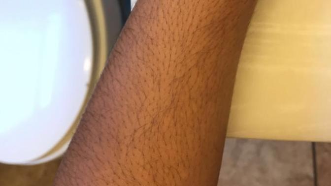 Is my arm hair a turnoff?