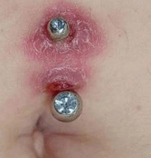 Is my belly button piercings rejecting?