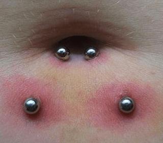 Is my belly button piercings rejecting?