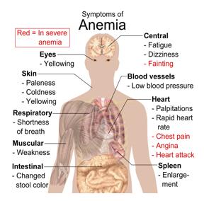 For those that used to be Vegan or Vegetarian but are not any longer - Did you become anemic or develop another type of sickness prior to quitting?