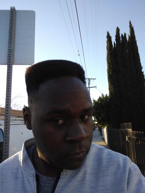 I think I'm I'm going bald/hair receding/thinning any tips to stop it?