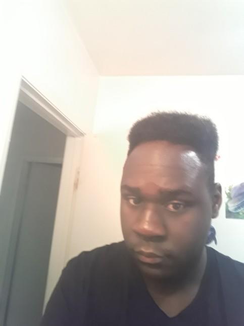 I think I'm I'm going bald/hair receding/thinning any tips to stop it?