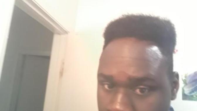 I think I'm I'm going bald/hair receding/thinning any tips to stop it?