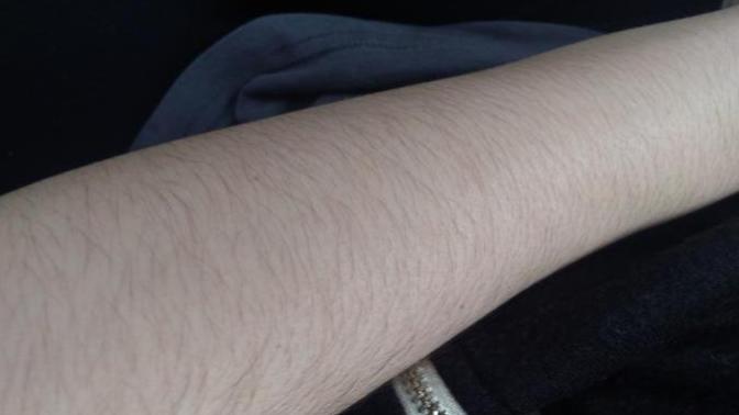 Do I have too much hair on my arm?