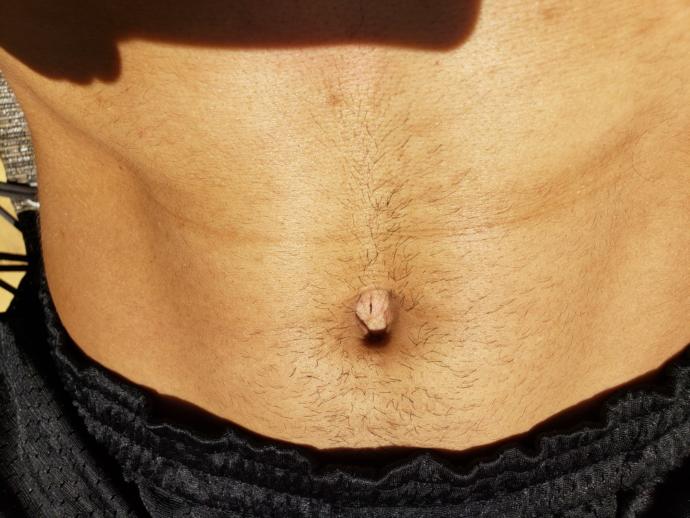 Is this crease on my abs normal? Anyone else have it?