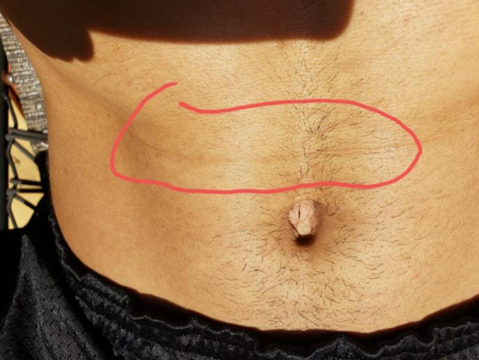 Is this crease on my abs normal? Anyone else have it?