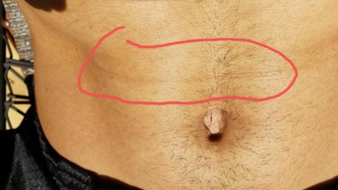 Is this crease on my abs normal? Anyone else have it?