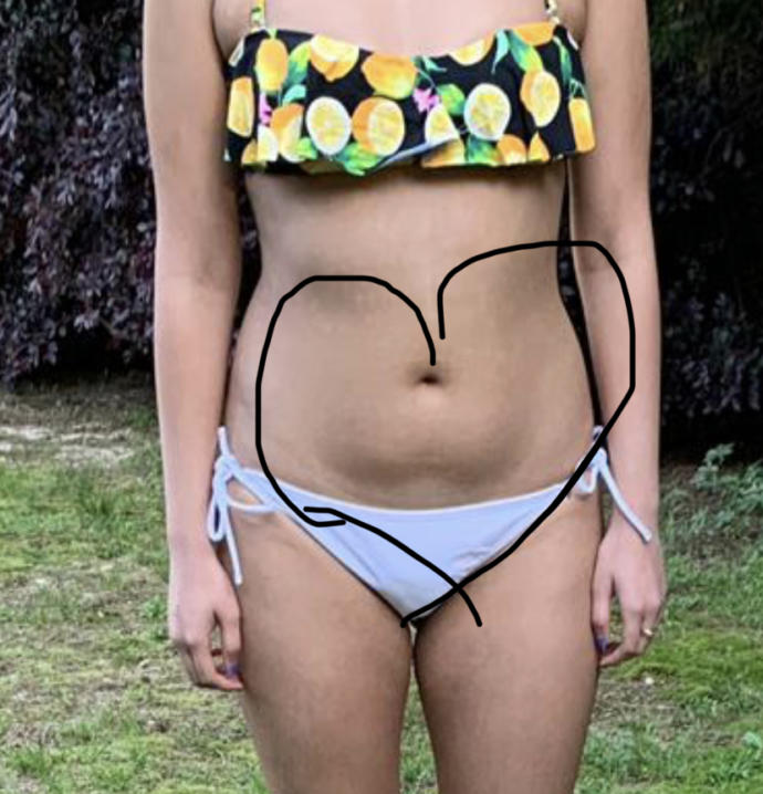 Are you okay with girls having a belly like this?