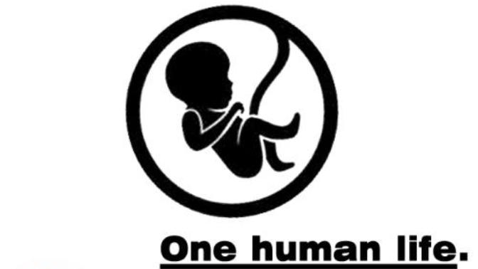 Does anyone happen to know how much an abortion cost?