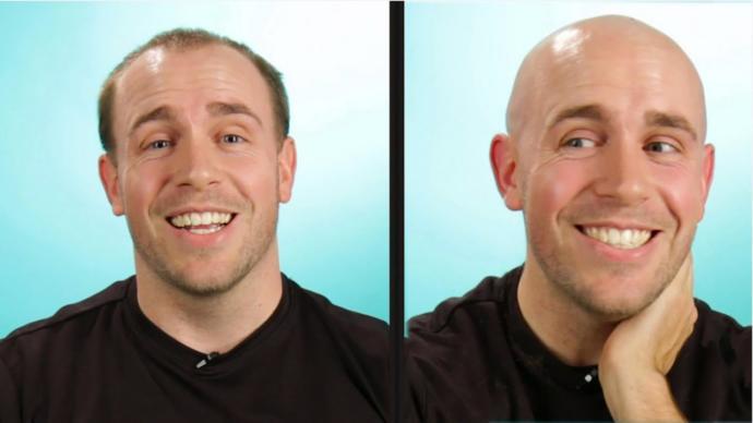 What do you do if you're going bald and you cannot pull it off?