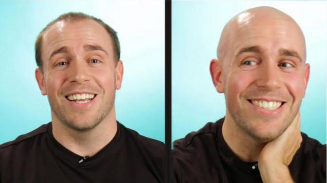 What do you do if you're going bald and you cannot pull it off?