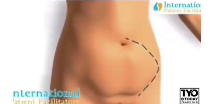 How do you get rid of this stupid belly pouch thingy?