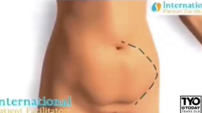 How do you get rid of this stupid belly pouch thingy?