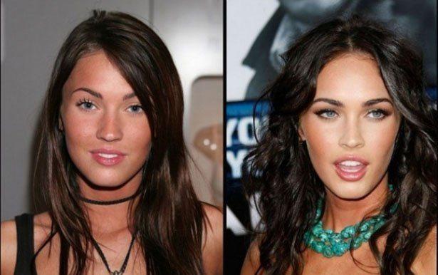 Does plastic surgery actually make a person look better?